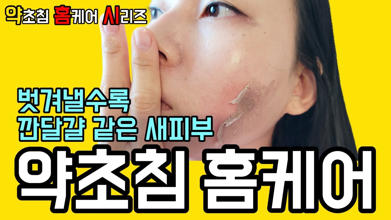 어떻게 후관리 하느냐에 따라 약초침 후기가 이렇게까지 천차만별⁉️😱 | #약초침 #약초필링 #셀프박피 #여드름흉터 | 젤쿠어 약초필링 강필 | 배유진 YUJIN B