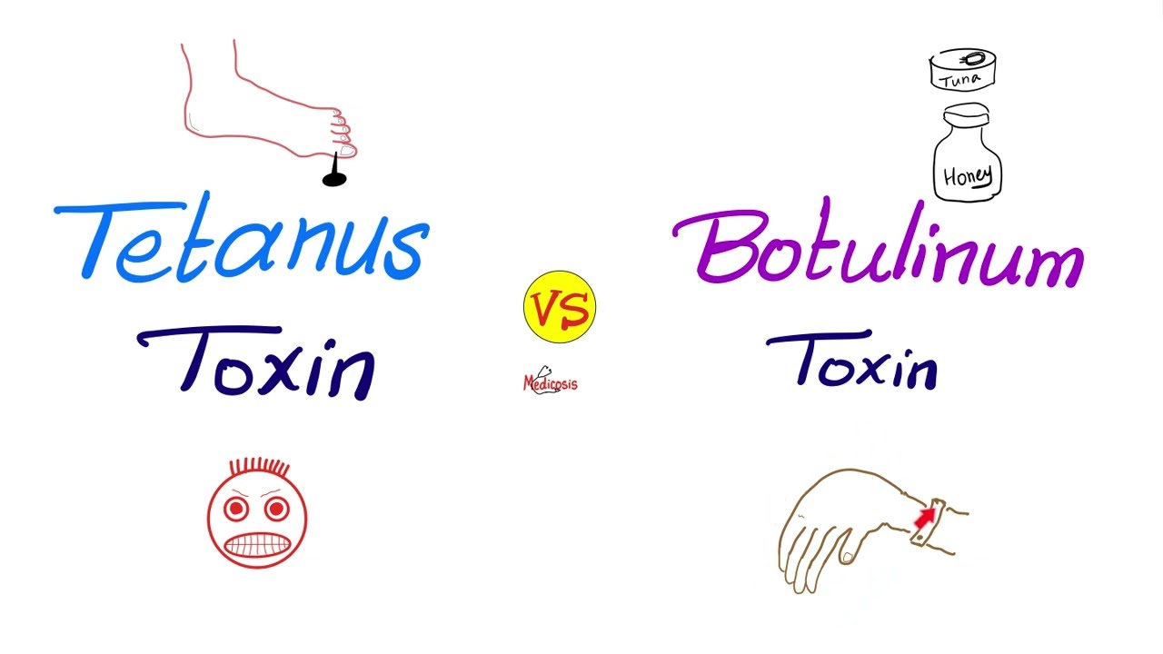 Tetanus Toxin vs Botulinum Toxin | Comparisons Series