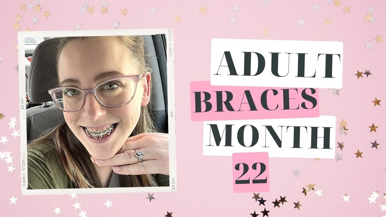 Adult Braces Month 22 | Dental Cleaning
