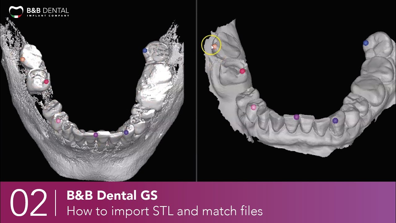B&B Dental GS - 02 - How to import STL and match files
