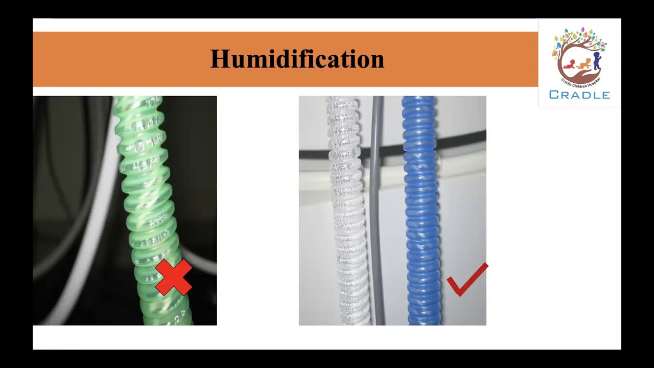 Ventilator associated Pneumonia and Central lIne associated blood stream infection in Neonates