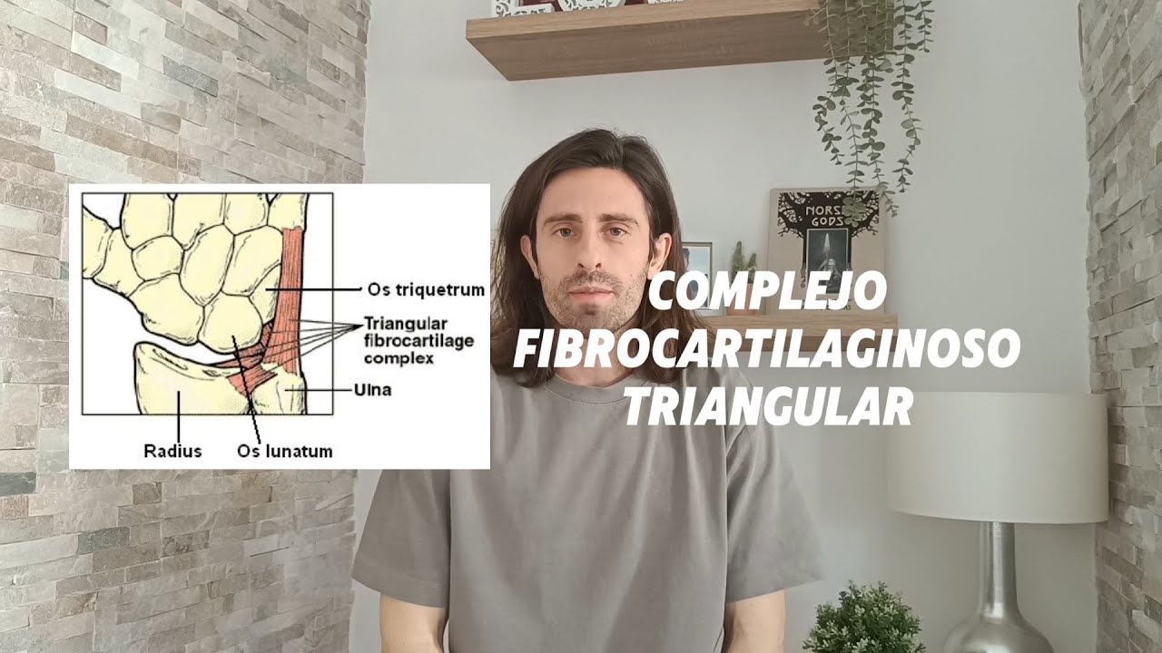 Dolor de muñeca | CFCT y Tendón ECC