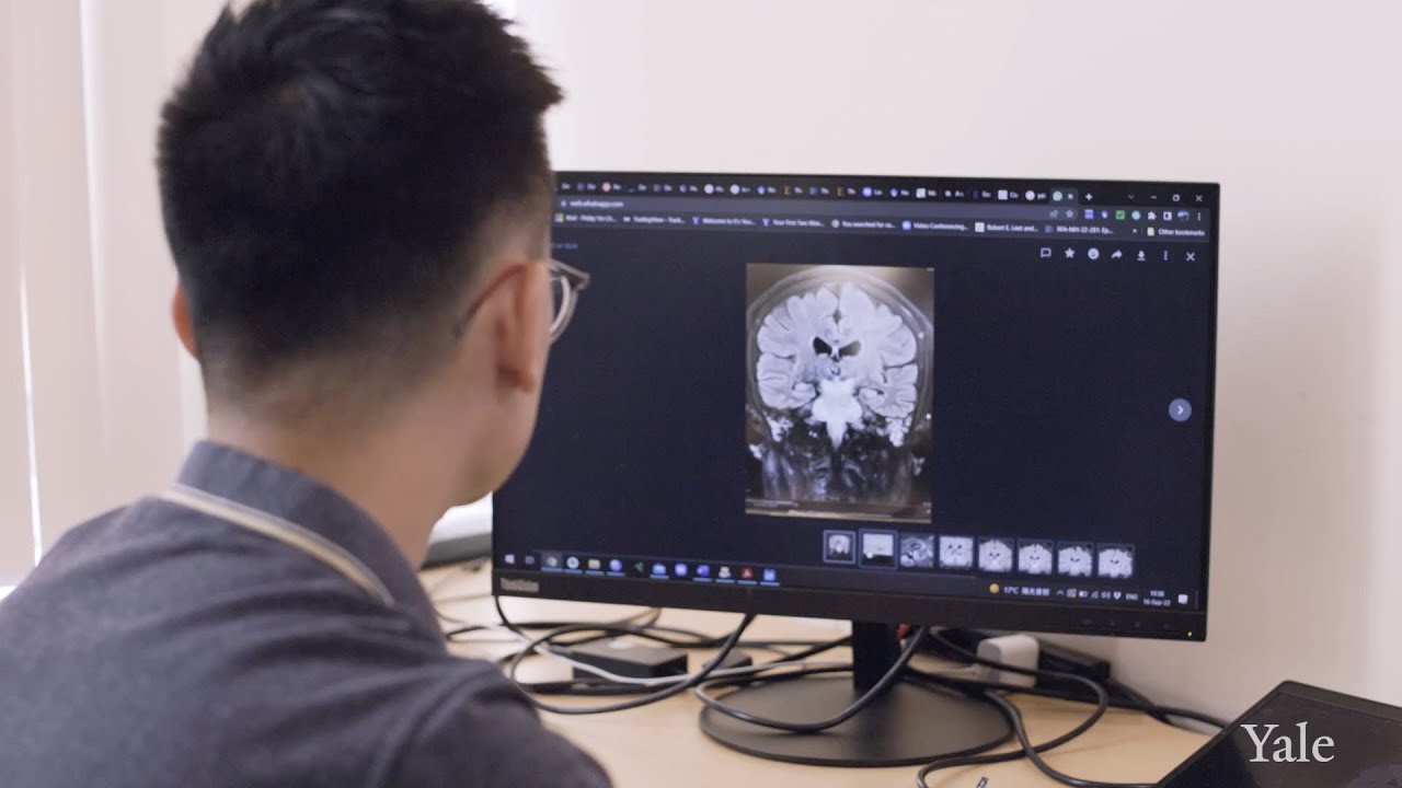 Yale School of Medicine Department of Neurology