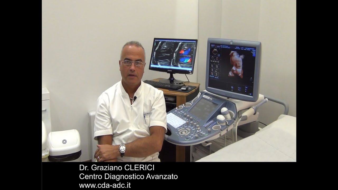 Ecografia Ostetrica: Suggerimenti di Base - Dr. G Clerici - http://www.cda-adc.it