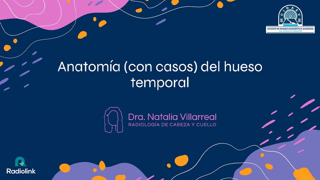 Anatomía de oído en radiología ׀ Dra. Natalia Villareal del Bosque ׀ CIDAEV