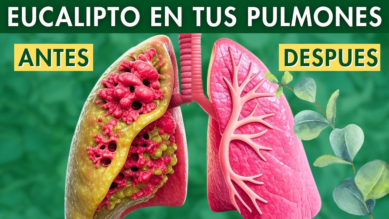 &iquest;Qu&eacute; Pasa En Tus PULMONES Cuando Consumes EUCALIPTO?