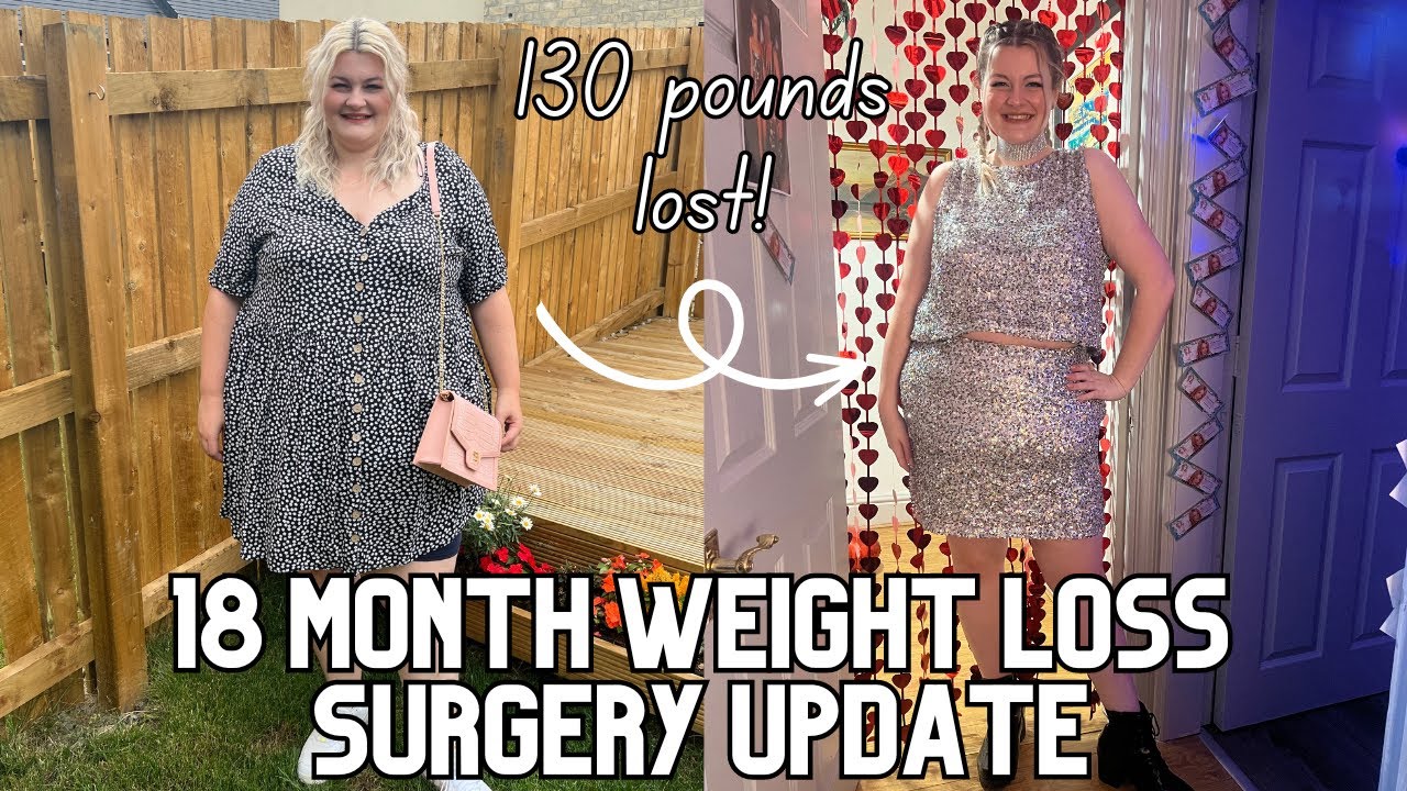 18 Month Weight Loss Surgery Update - It's been really tough!