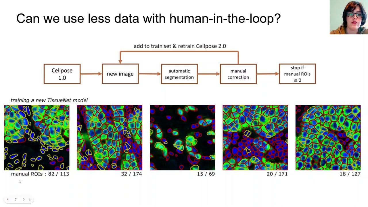 cellpose 2.0: how to train your own cellular segmentation model