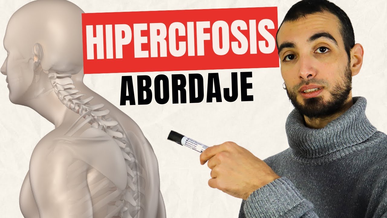 Cómo abordar una hipercifosis en Yoga