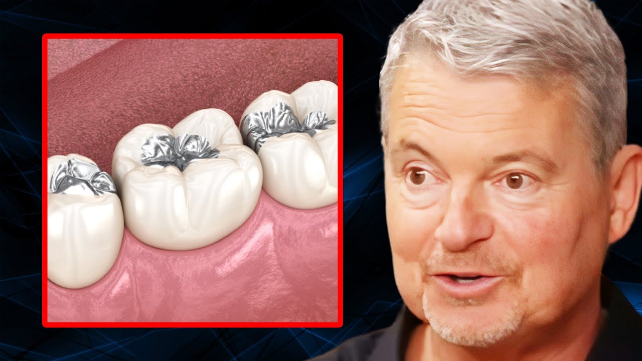 Dental Amalgam Danger: What You NEED to Know about Mercury Fillings! | Dr. Mark Burhenne