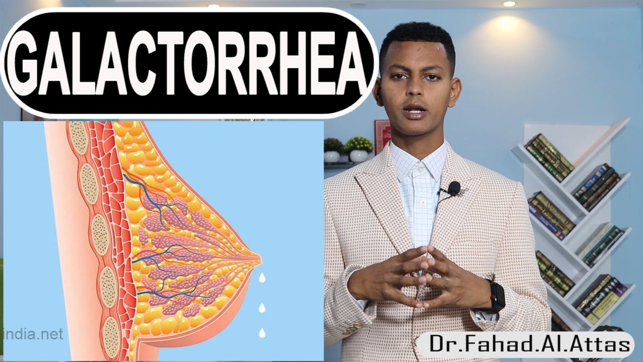 MAXAA SABABO IN NAASAHA DUMARKA CAANO KA YIMAADO IYAGOO AAN SAMENEEN NAAS NUUJIN?