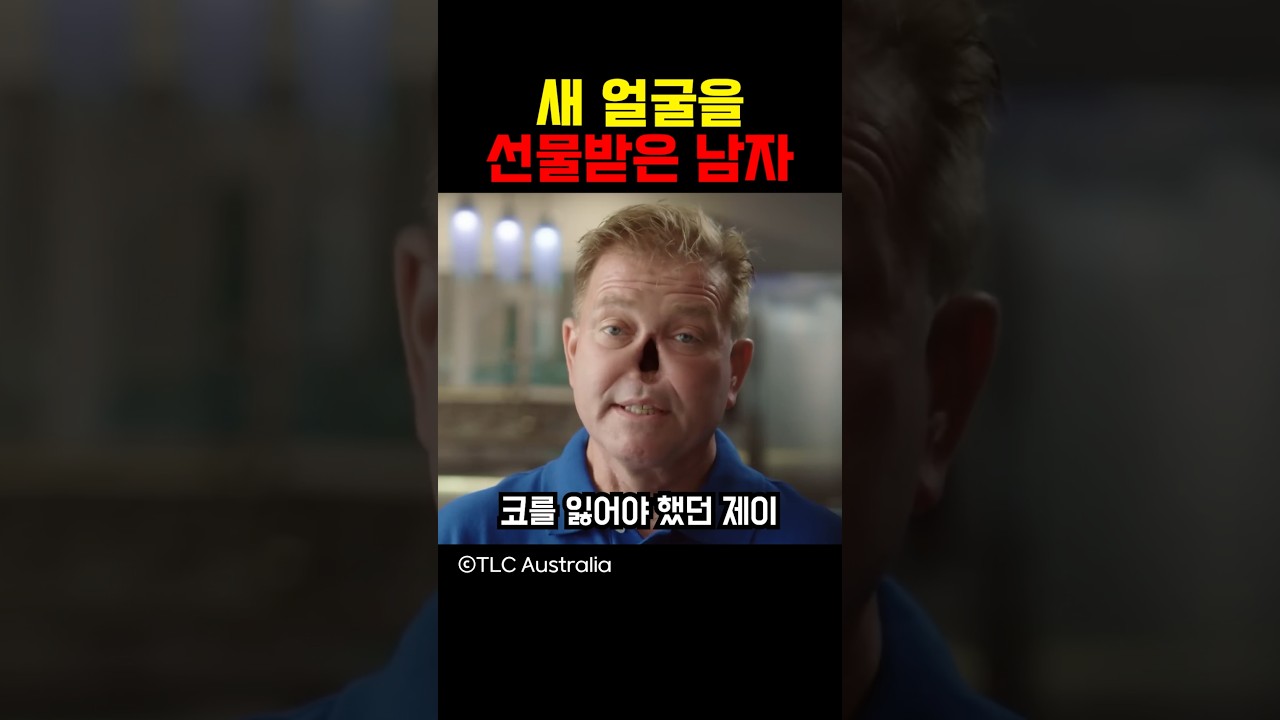 새 얼굴을 선물받은 남자
