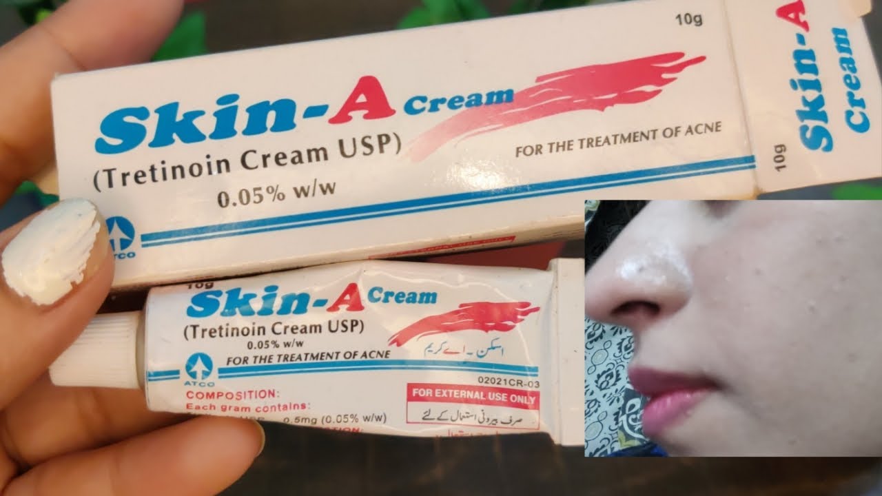 skin a cream | skin a cream tretinoin cream USP 0.05 | skin a cream review / su beauty and remedies