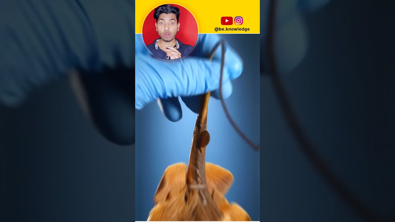 Stingray fish stinger can kill you ||Stingray fish Attack || Stingray fish poison #amazingfacts