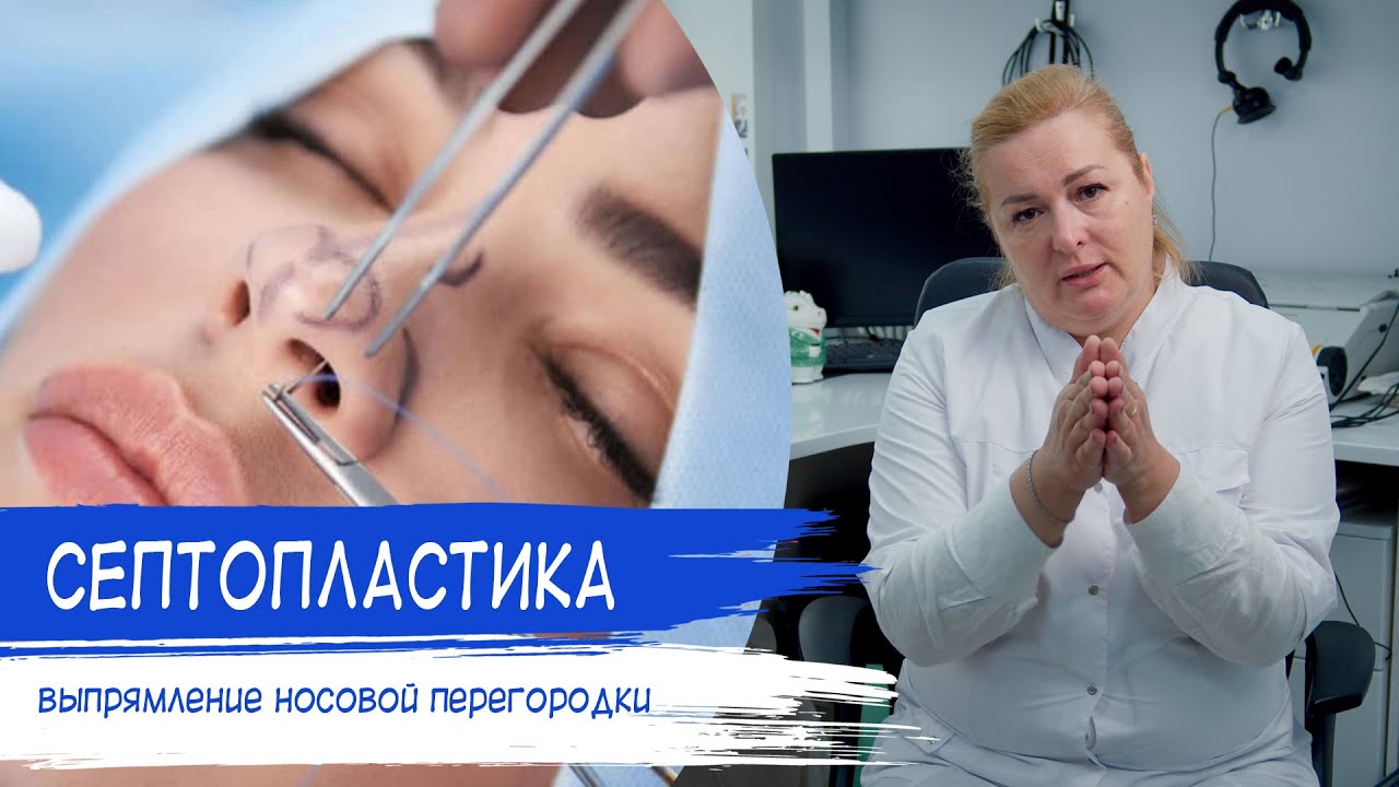 СЕПТОПЛАСТИКА | Искривление носовой перегородки