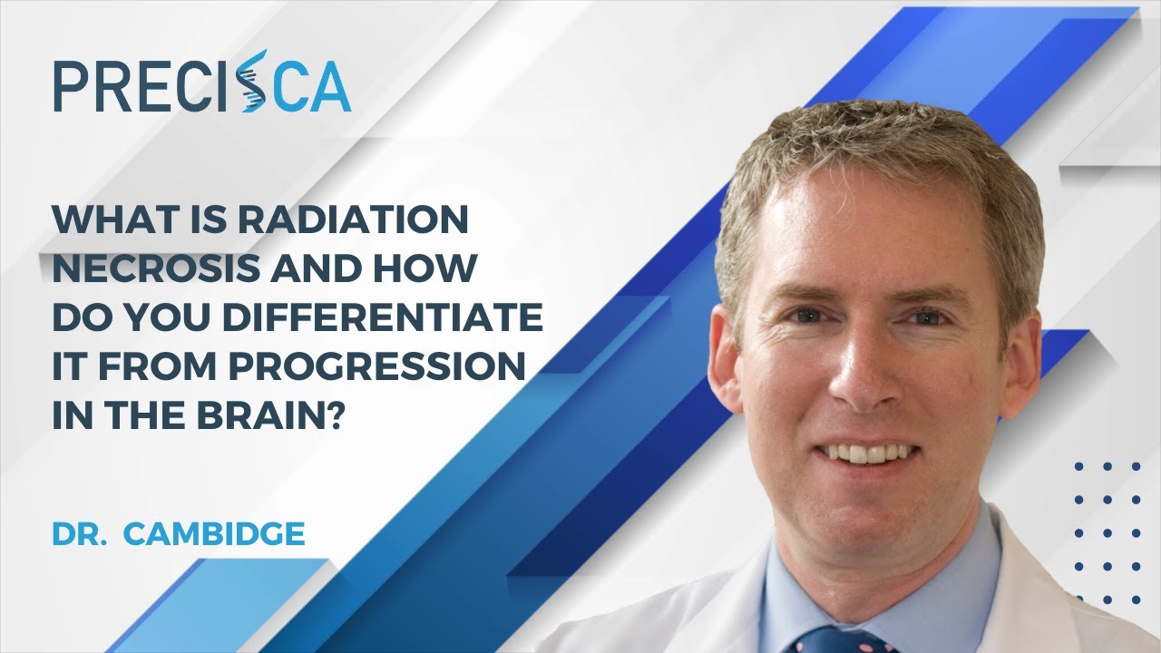 What is radiation necrosis and how do you differentiate it from progression in the brain?