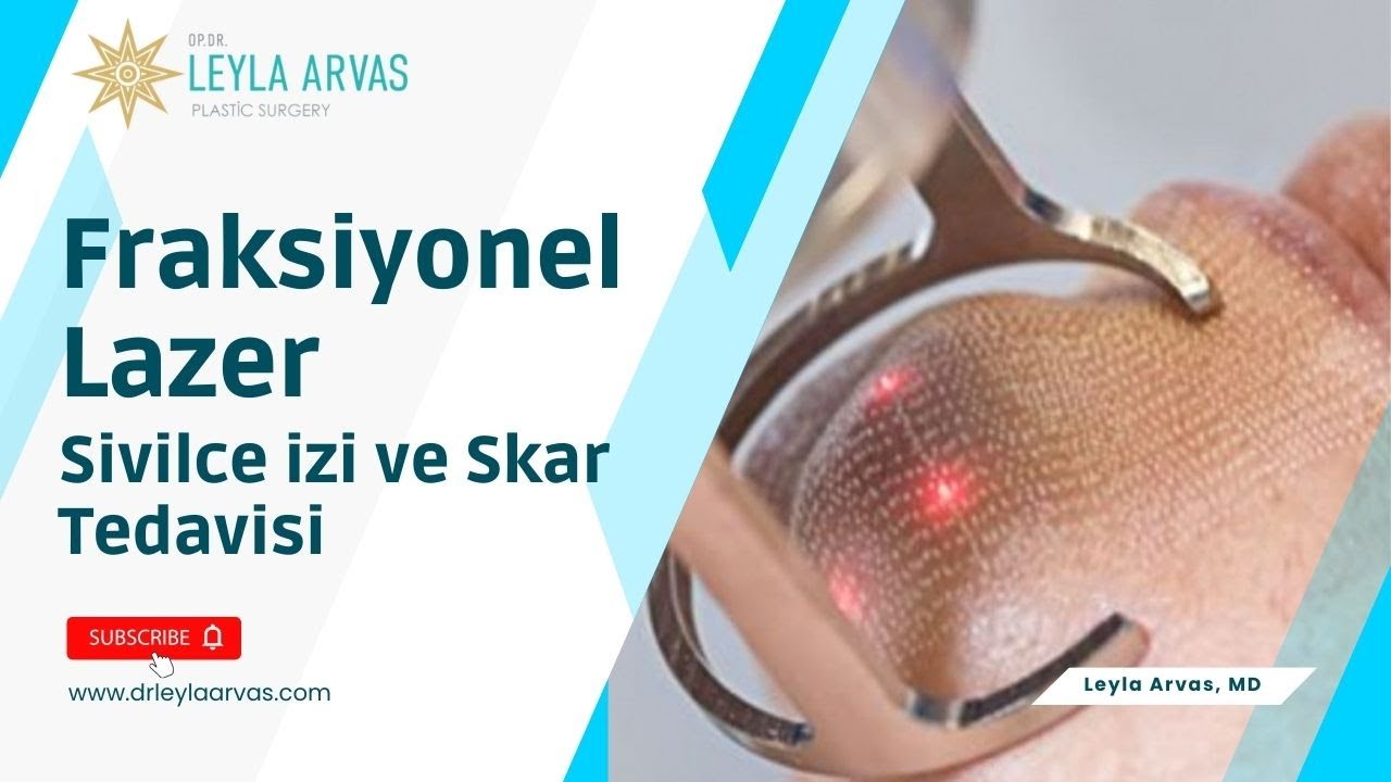 Fraksiyonel Lazer ile Sivilce İzi ve Skar Tedavisi | Op. Dr. Leyla Arvas
