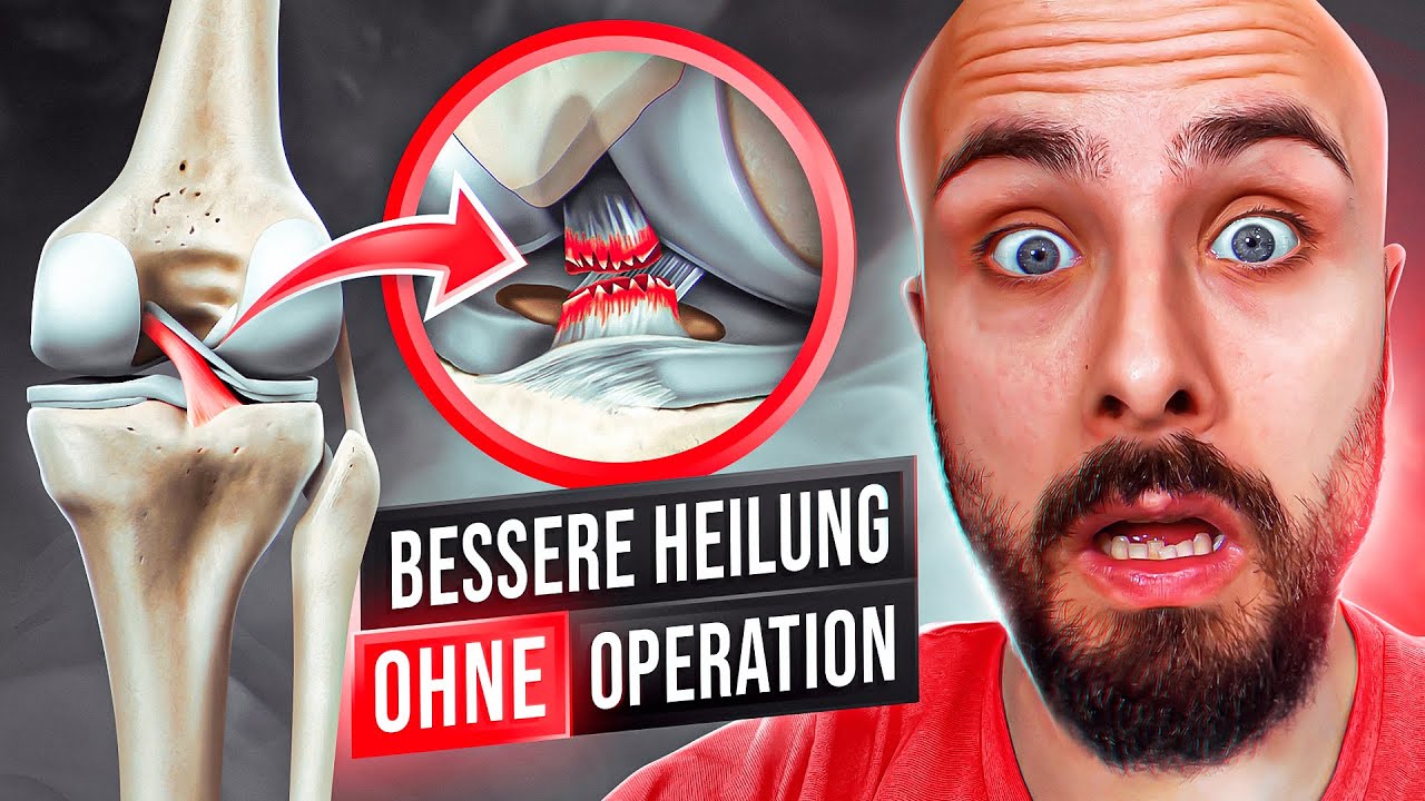 Kreuzband- Operation ja oder nein? (Diese Fakten kennen die wenigsten)