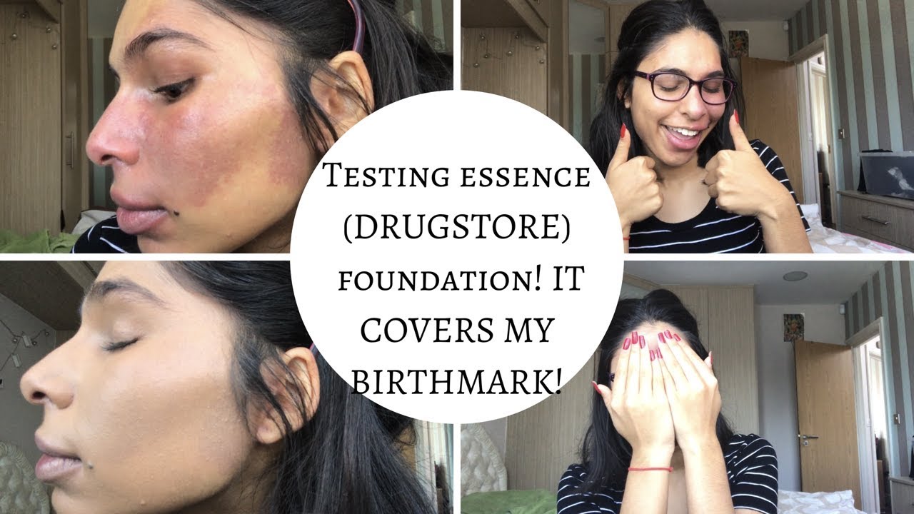 A DRUGSTORE FOUNDATION COVERING MY BIRTHMARK (PORT WINE STAIN)!