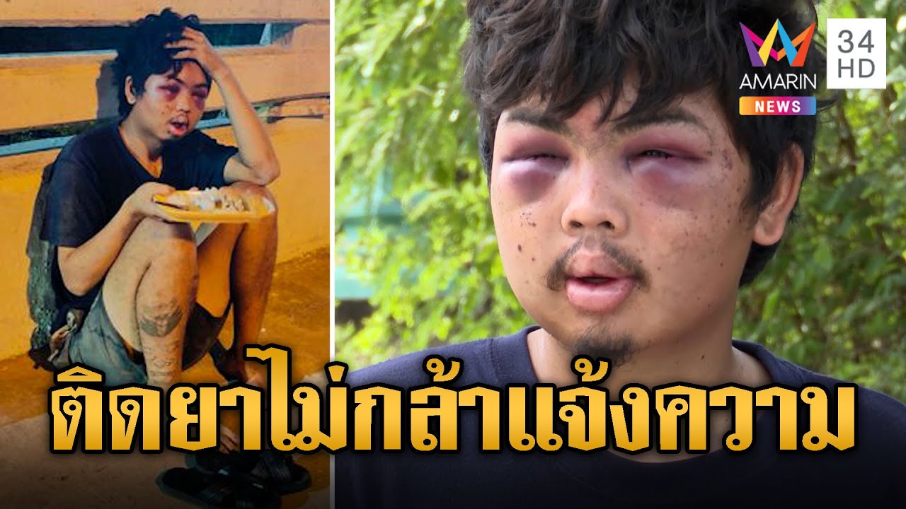 วอนช่วยเด็ก 19 ตาปูดนั่งกินข้าว ไม่กล้าแจ้งความสารภาพเสพยา | ข่าวเที่ยงอมรินทร์ | 15 ธ.ค. 66