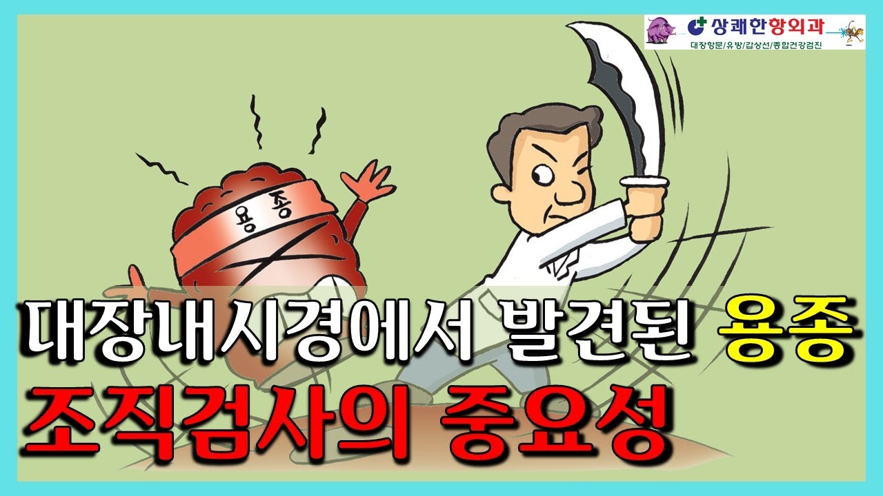 대장내시경에서 발견된 용종, 조직검사의 중요성