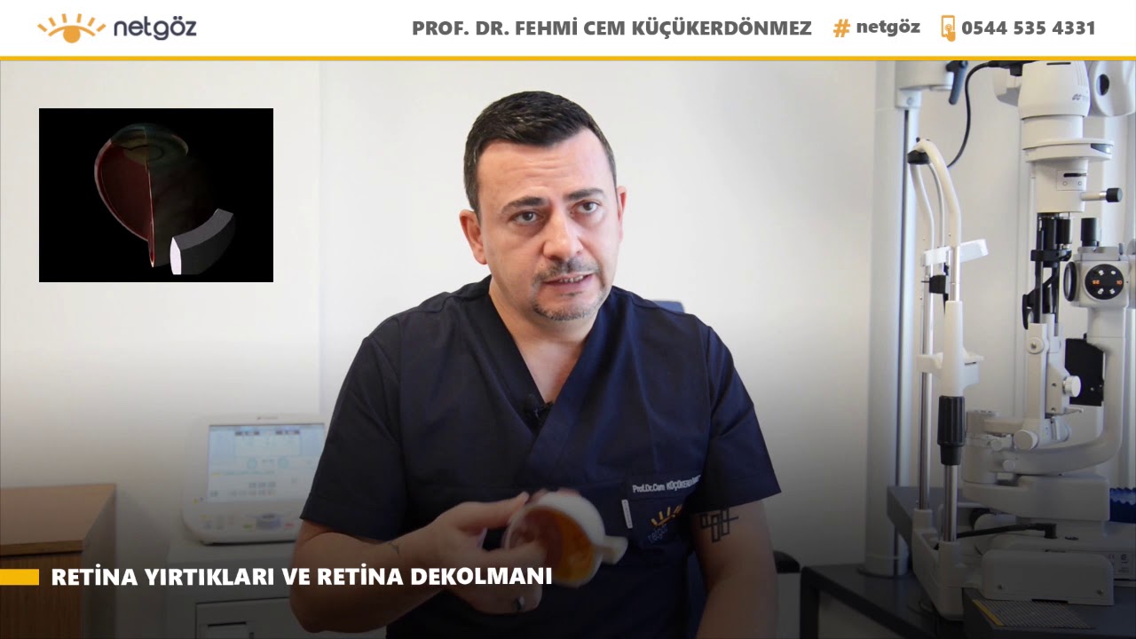 Prof. Dr. Fehmi Cem Küçükerdönmez - Retina Yırtığı, Retina Dekolmanı
