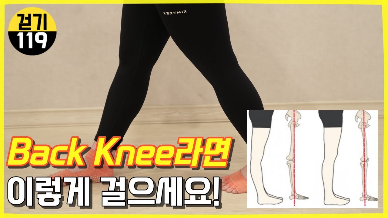 무릎이 뒤로 휘어지는 백니(Back Knee), 반장슬이 있다면 OO걷기와 OO운동을 추천합니다!