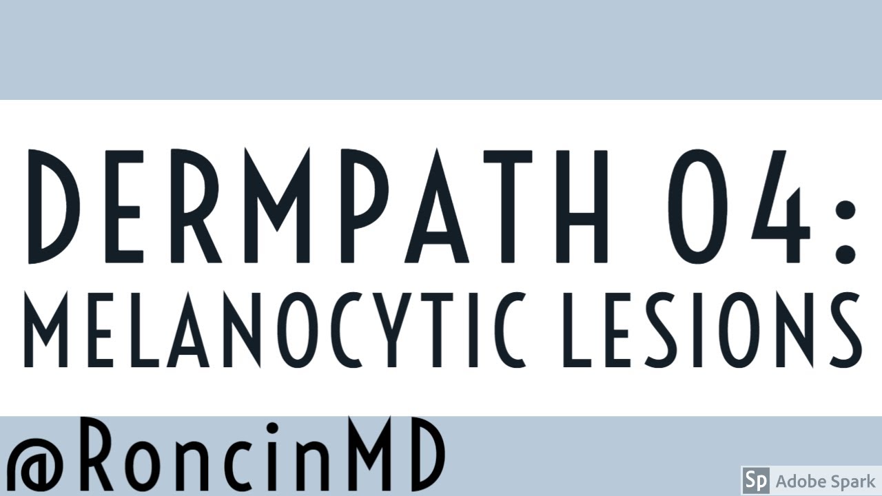 Slide Review: Derm 04 - Melanocytic Lesions