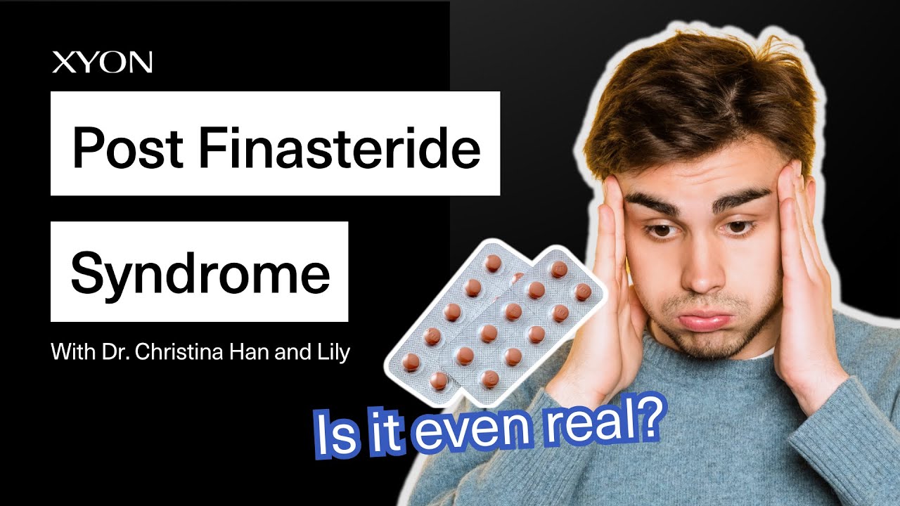Post Finasteride Syndrome | What Is It? Is It Real? Does It last?