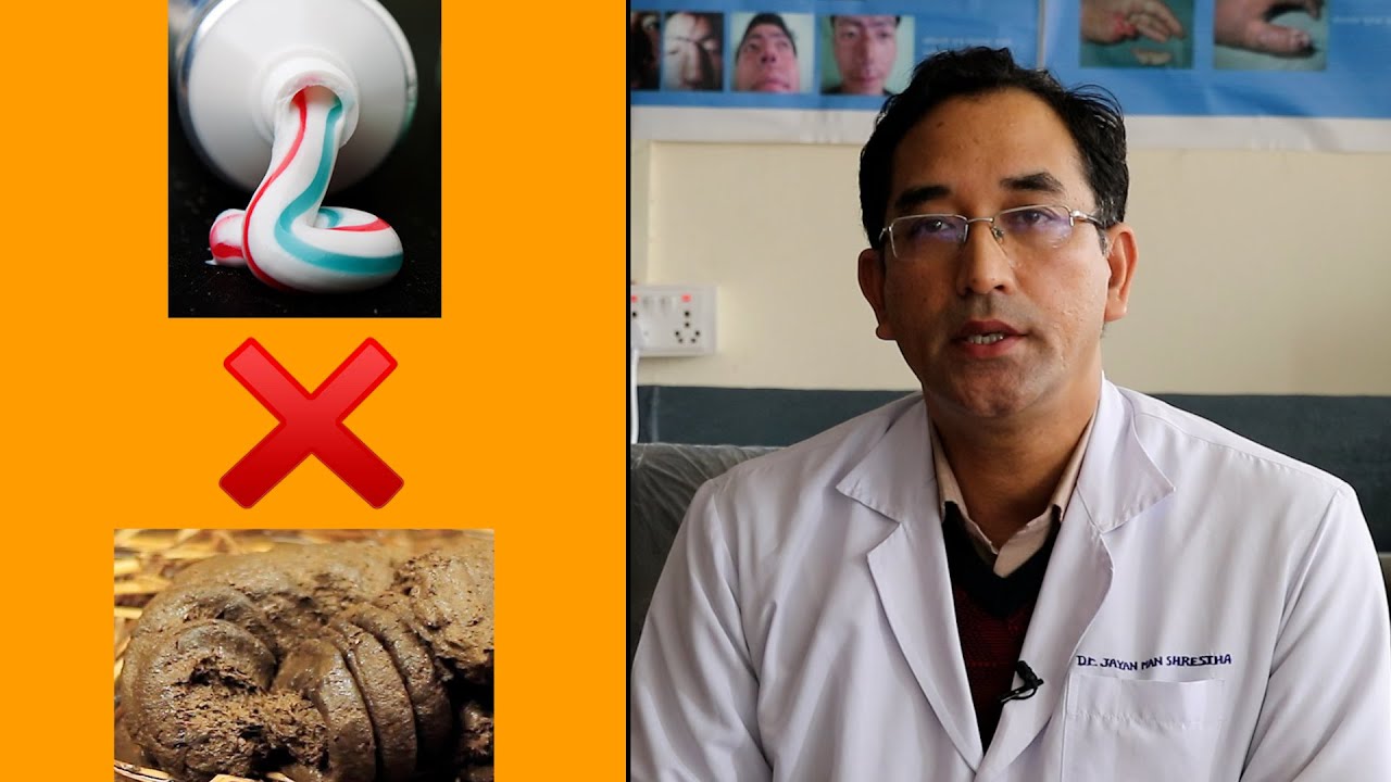 आगोले पोलेको ठाउँमा लगाउनु हुन्न गोबर र टुथपेस्ट, अरू के-के कुरा ख्याल गर्ने?
