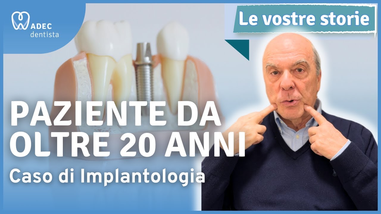 Implantologia e chirurgia | La storia di Gianni | ADEC Dentista Milano
