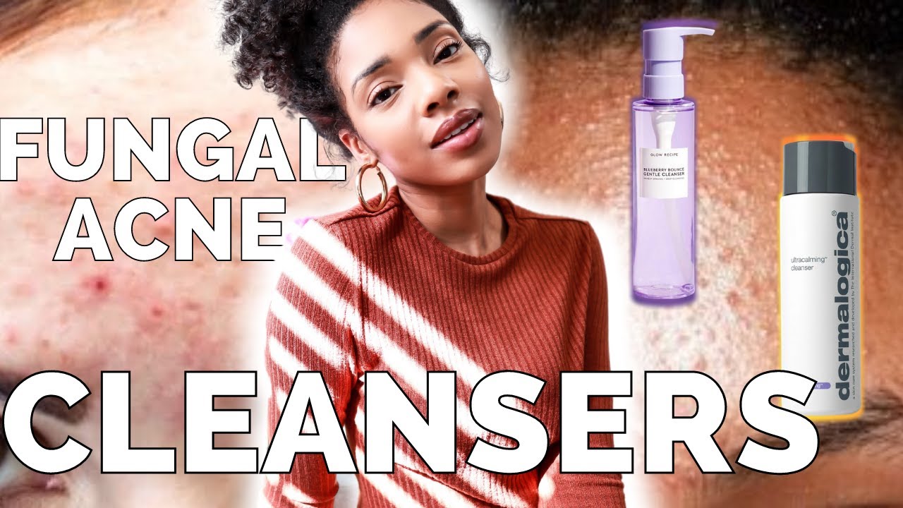 THE BEST CLEANSER | Fungal Acne Safe (glow recipe, dermalogica, & more)