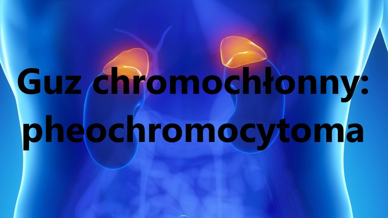 Guz chromochłonny: pheochromocytoma [Medycyna  w prosty sposób cz.7]