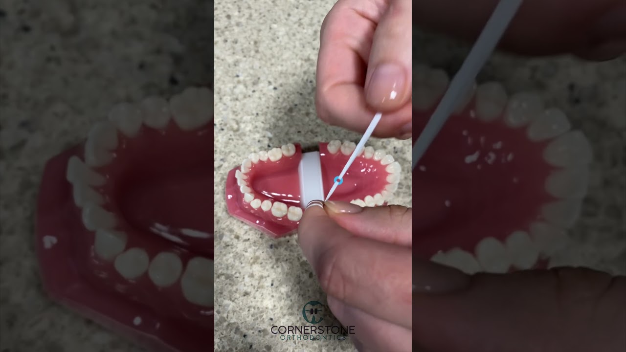 How to replace a spacer/separator