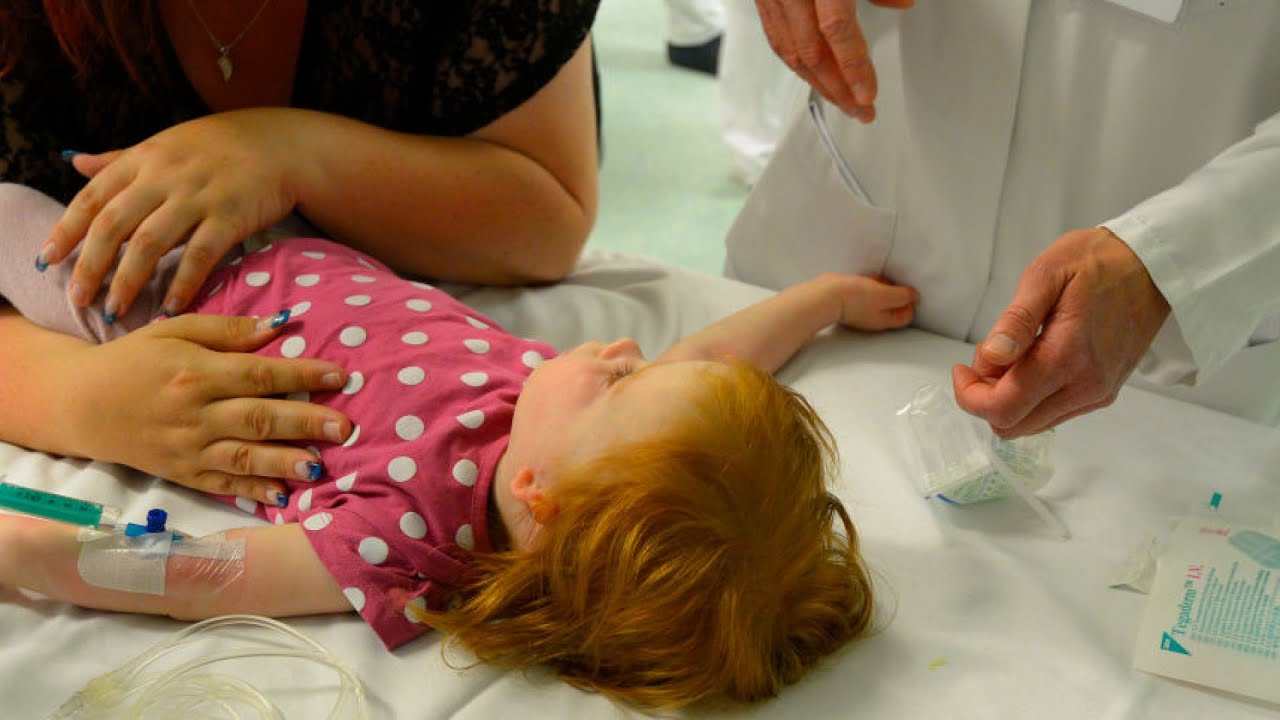 Epilepsia infantil: causas, síntomas y la importancia de tomar consciencia sobre esta