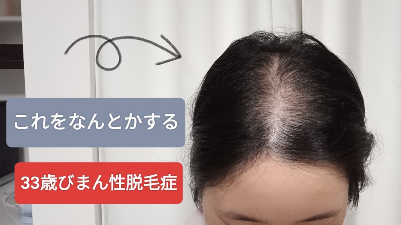 結局マジックパウダーでなんとかなる