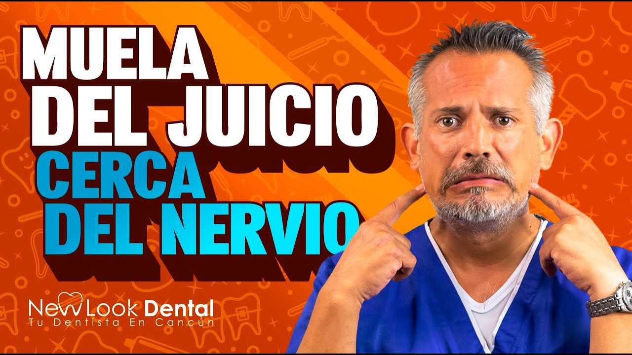 MUELA DEL JUICIO cerca del NERVIO 🦷 Consulta tu 𝘾𝙞𝙧𝙪𝙟𝙖𝙣𝙤 𝙈𝙖𝙭𝙞𝙡𝙤𝙛𝙖𝙘𝙞𝙖𝙡 en Canc&uacute;n 🌊🐚