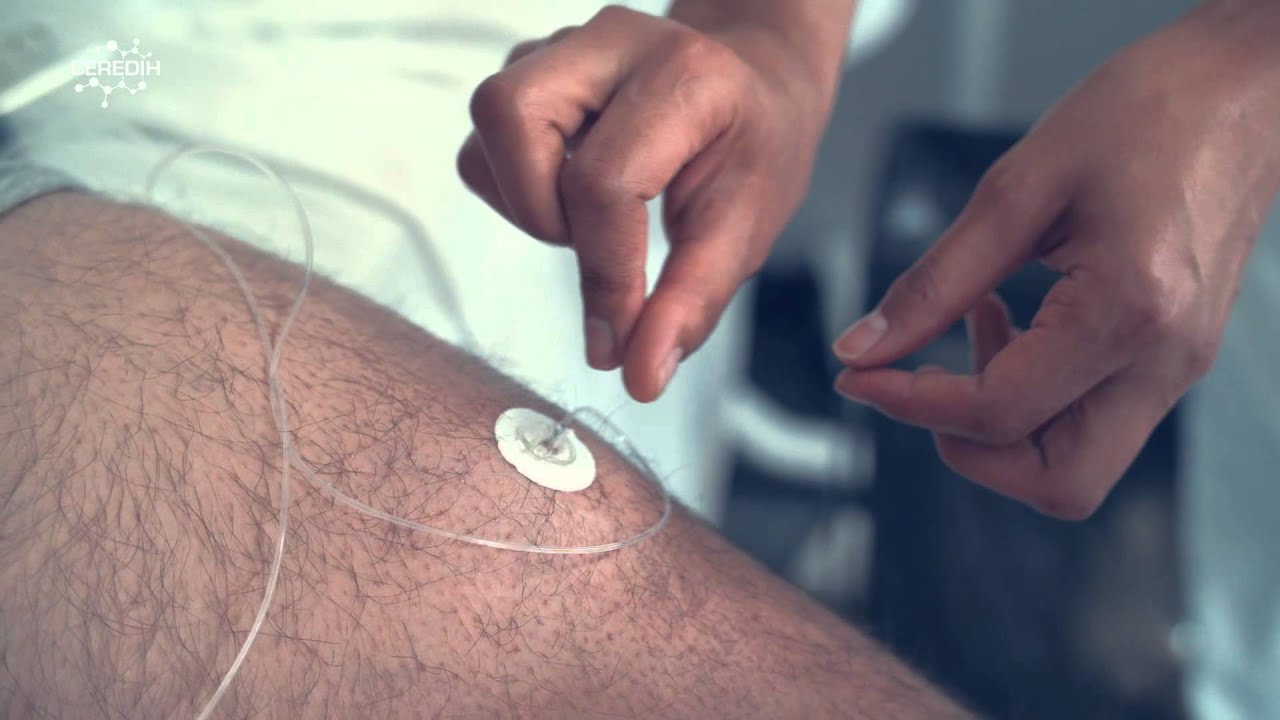 Film dédié à la substitution par immunoglobulines à domicile des DIH - IRIS
