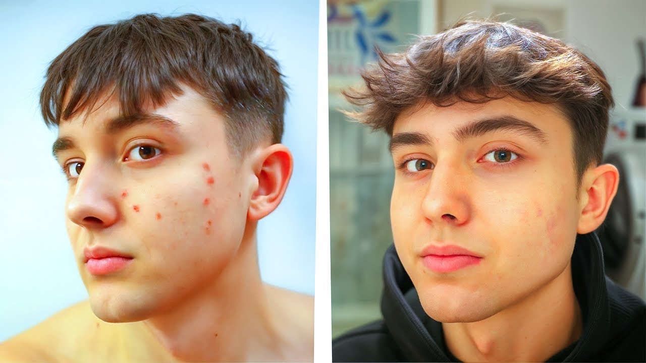Przetestowałem Looksmaxxing Przez 365 Dni