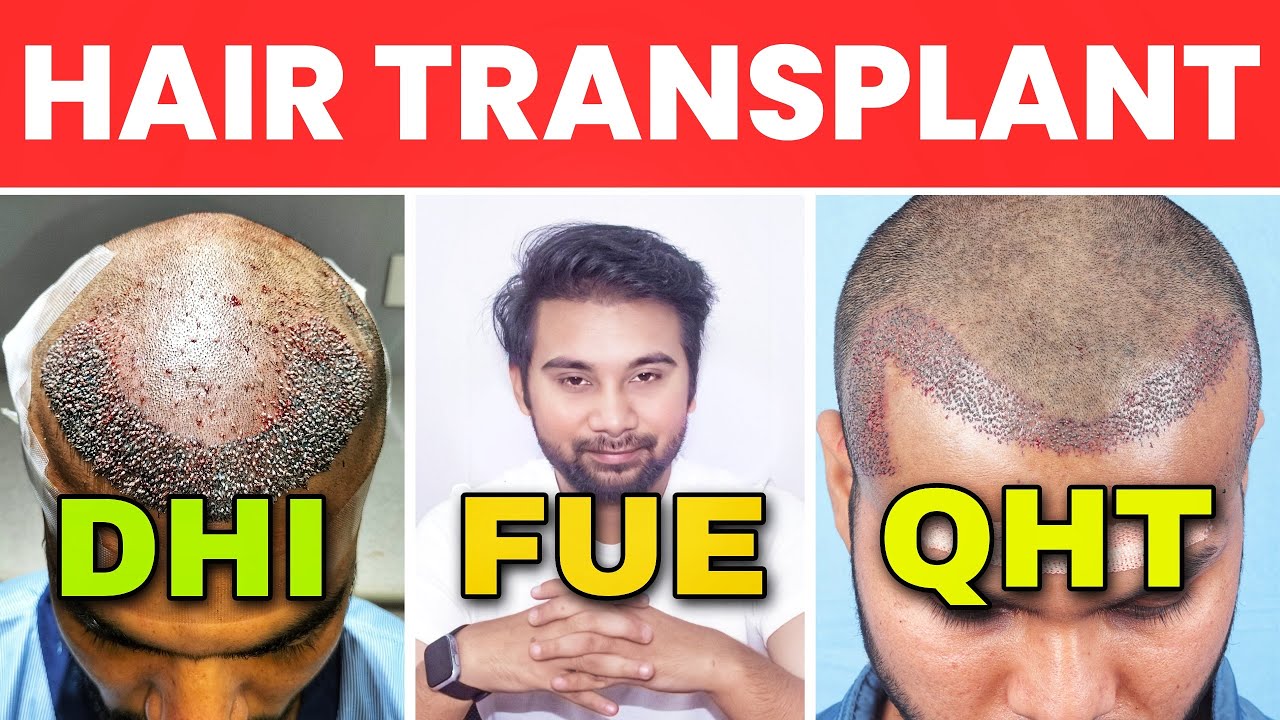 FUE Vs DHI Vs QHT Hair Transplant Results Comparison | Hair Transplant Grafts Cheating Now A Days ?