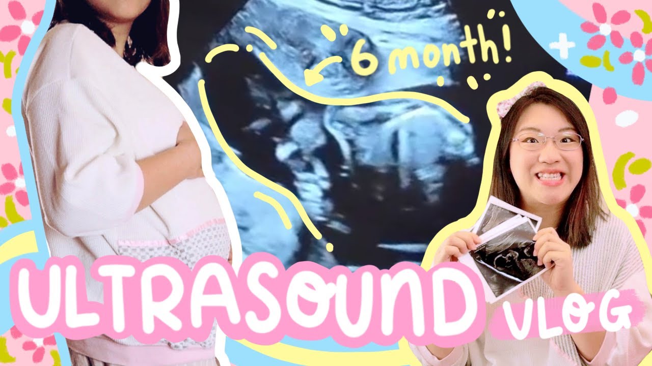 I&rsquo;m Pregnant!! 🤰 Meet Our Alien Baby 👽| First Ultrasound Vlog