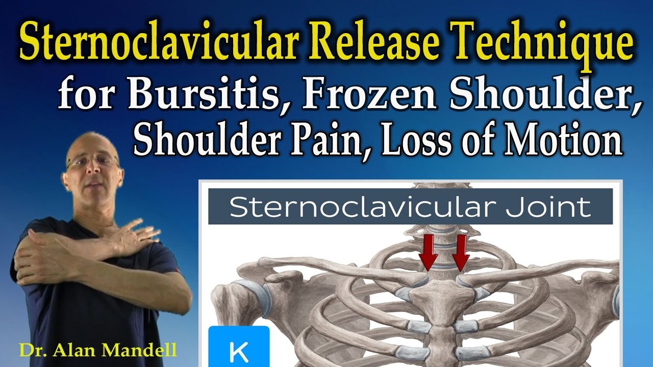 Sternoclavicular Release Technique for Frozen Shoulder Pain, Bursitis, Loss of Motion - Dr Mandell