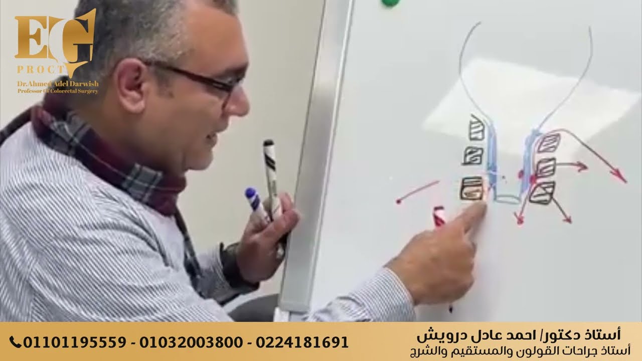 كيفية التعامل مع الناسور الشرجي ومعنى إجراء العملية على مراحل مع أ.د أحمد عادل درويش