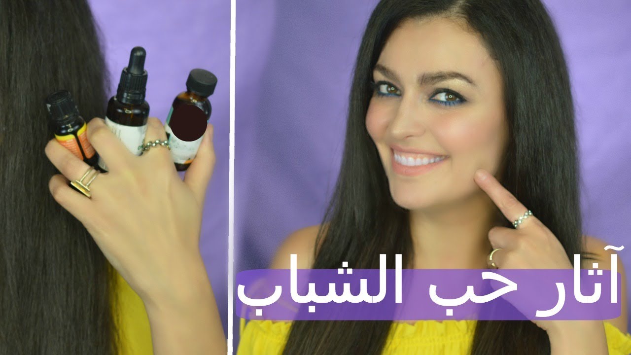 خلطة طبيعية رائعة لإزالة آثار حب الشباب