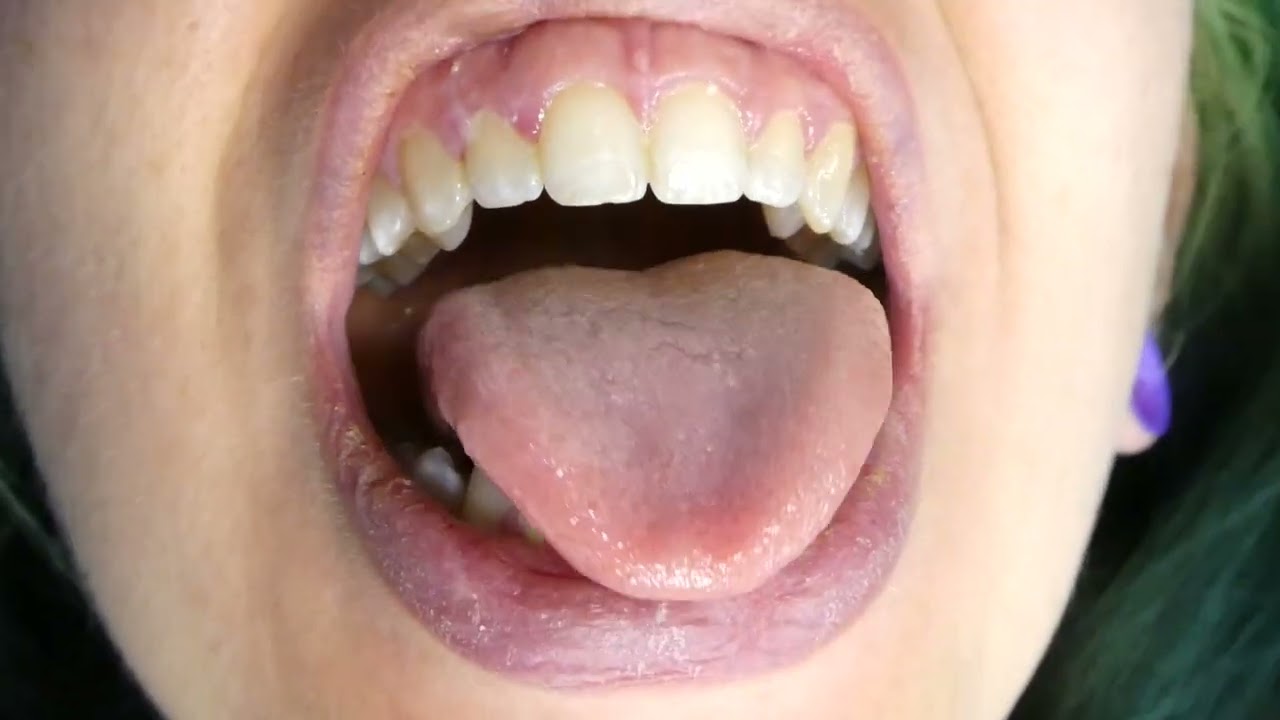 Dirty Dental Display #teeth #tongue #lips