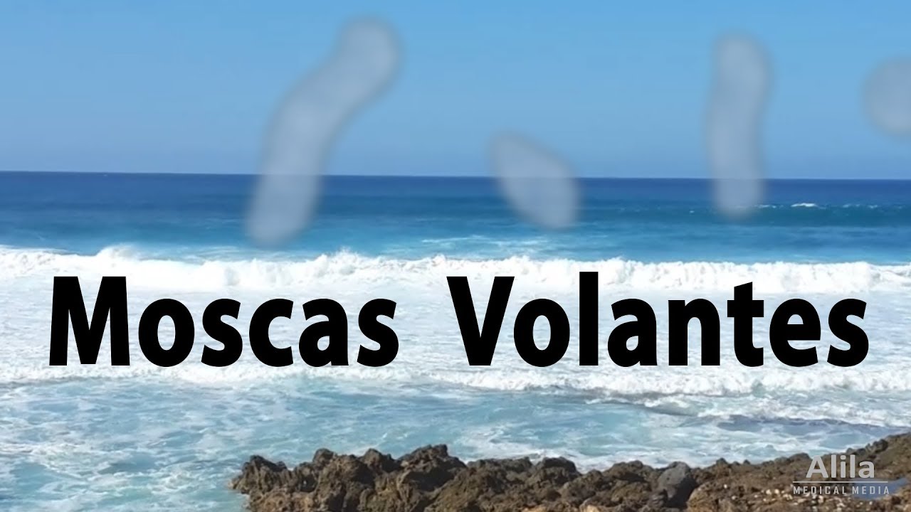 Moscas Volantes nos Olhos,  Animação. Alila Medical Media Português
