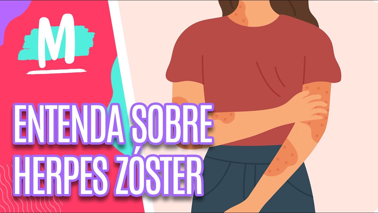 HERPES ZÓSTER: Entenda mais sobre o assunto - Mulheres (16/05/2023)