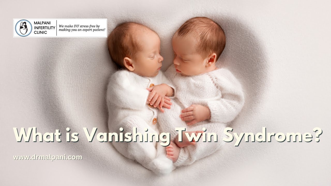What is Vanishing Twin Syndrome ? Disappearing Twins