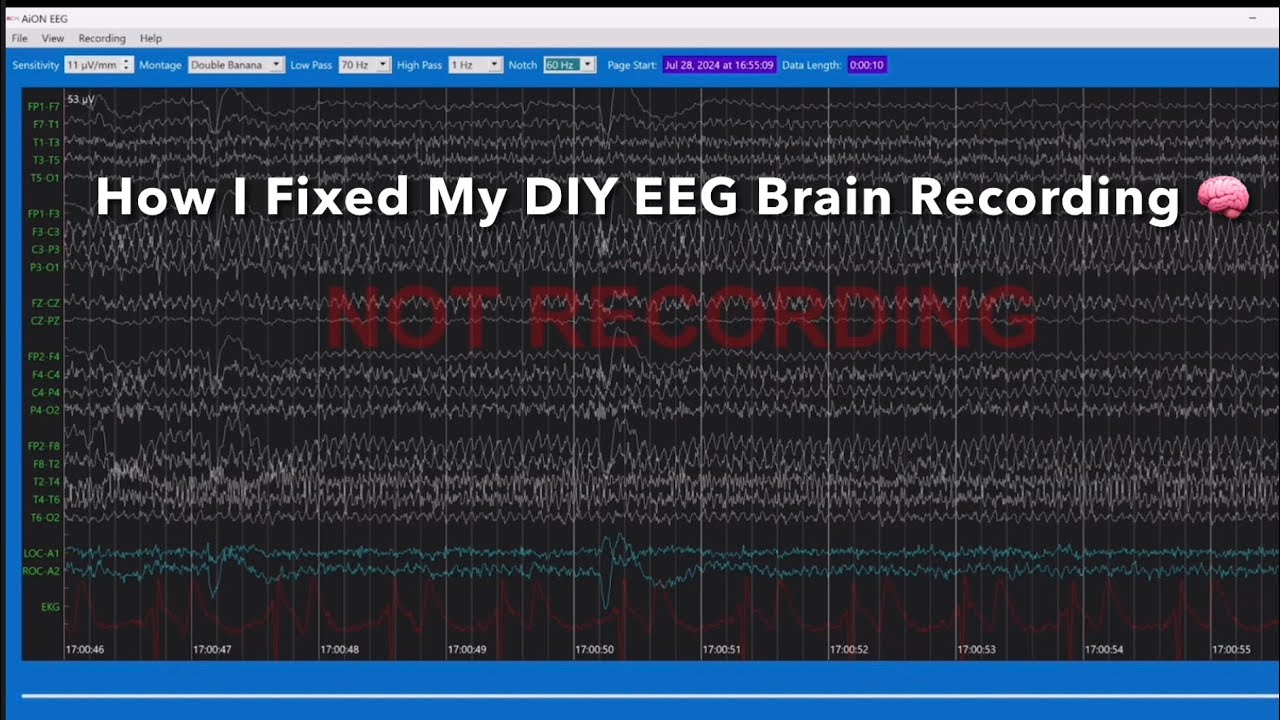 How I Fixed My DIY EEG Brain Recording Machine