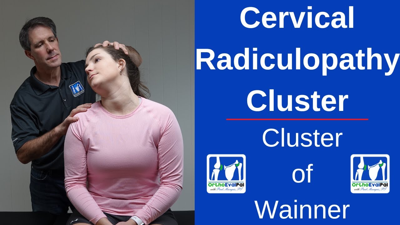 Cervical Radiculopathy Cluster (Cluster of Wainner)